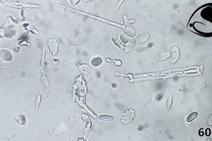 Ichthyobodo necator